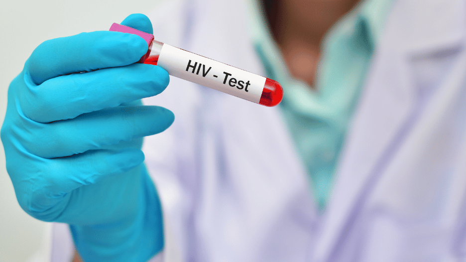 HIV Testing at Needle Exchanges in Florida HIV Testing at Needle Exchanges in Florida
