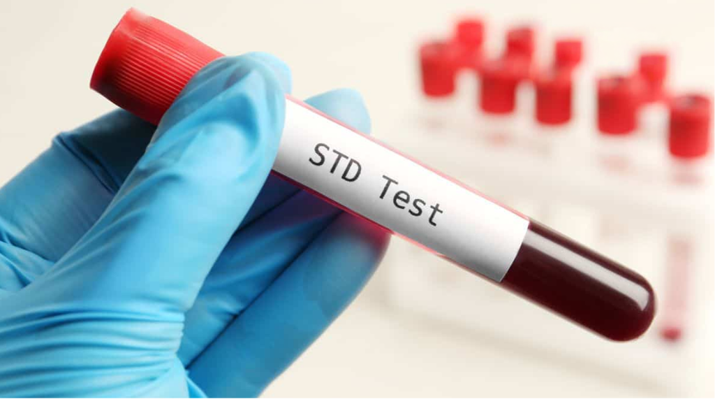 STD Testing Florida Harm Reduction